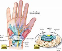 Image result for Anatomy Wrist Carpal Tunnel