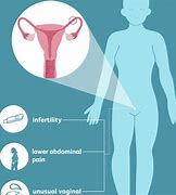 Image result for Blocked Fallopian Tube Symptoms