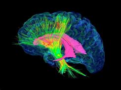 Image result for Pea Brain MRI