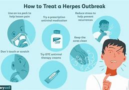 Image result for herpes