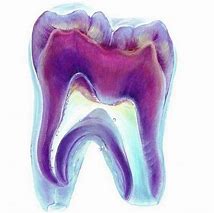 Image result for Eulipotyphla Teeth