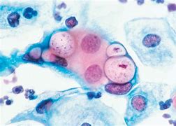 Image result for Microscopic Image of Chlamydia Trachomatis