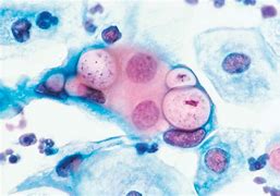 Image result for Chlamydia Histology