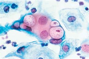 Image result for Chlamydia Gram Stain