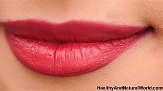 Image result for Chlamydia On Lips