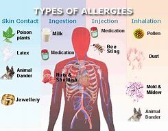 Image result for Type 1 Allergic Reaction