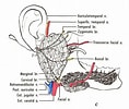 Bildergebnis für Teratome der Glandula parotitis. Größe: 118 x 100. Quelle: www.pinterest.co.uk