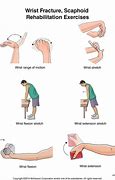 Image result for Broken Wrist Therapy Exercises