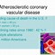 Image result for Atherosclerosis Progression
