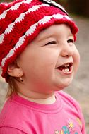 Image result for Baby with Lissencephaly