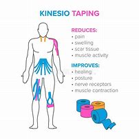Image result for kinesiolog�a