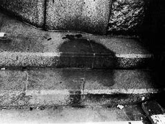 Image result for Nagasaki Atomic Bombing Victims