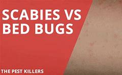 Image result for Scabies Bed Bugs