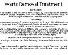 Image result for Wart Removal Surgery