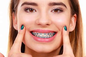 Image result for Smiling Face with Braces Emoji