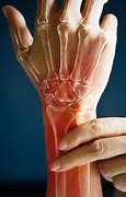 Image result for Hand Wrist Pain
