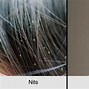 Image result for Head Lice vs Crabs