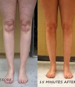 Image result for Red and Itchy After Tanning Bed