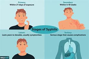 Image result for Late-Stage Syphilis