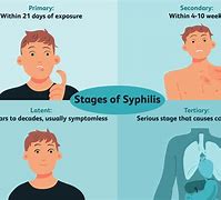 Image result for Syphilis