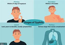 Image result for Syphilis Stages