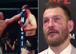 Image result for Daniel Cormier Last Fight Eye Poke