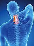 Image result for Neck Pain Chiropractor