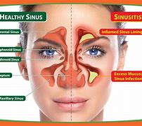 Image result for Nose Bone Pain