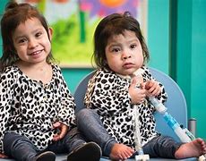 Image result for Conjoined Twins Grown Up