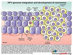 Image result for HPV Diagram