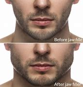 Image result for Men's Sharp Jawline Cream