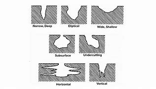 Image result for Steel Pipe Pitting Corrosion