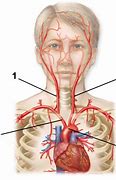 Image result for Carotid Arteries