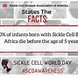 Image result for Sickle Cell Trait Genetics