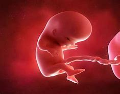 Image result for feto