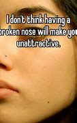 Image result for Broken Nose Meme