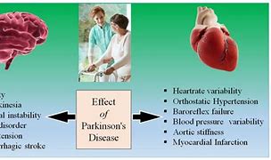 Image result for Atherosclerosis in Hand On XR