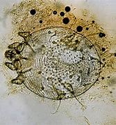 Image result for itch bugs under microscopes