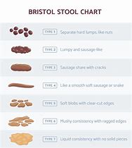 Image result for Stool Body