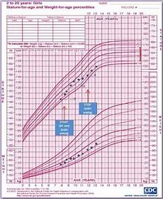 Figure 1 Precocious Puberty In Turner Syndrome Report Of