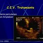 Image result for ecg cia