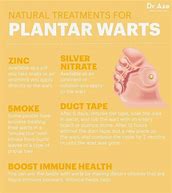 Image result for How to Get Rid of Warts Disease