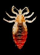 Image result for What Does Lice Look Like When Dead