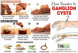 Image result for Home Cure Interdigital Cyst