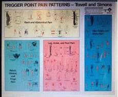 Surprise Trigger Point Therapy For Feet Is In Your Calf