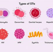 Image result for STD On Women