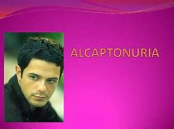 Image result for alcaptonuris