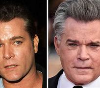 Image result for Ray Liotta Hair Transplant
