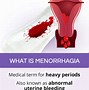 Image result for Menorrhagia