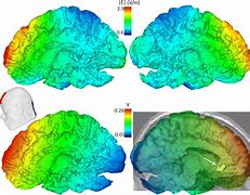 Image result for Electric Map of the Brain